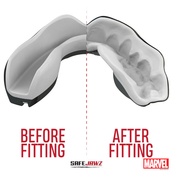 SafeJawz&reg; Marvel Venom Mouthguard Adult, Assorts